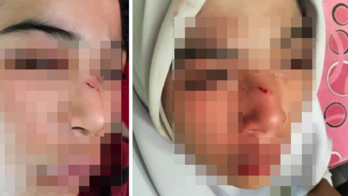 Kelantan Education Department launches probe into student assault case