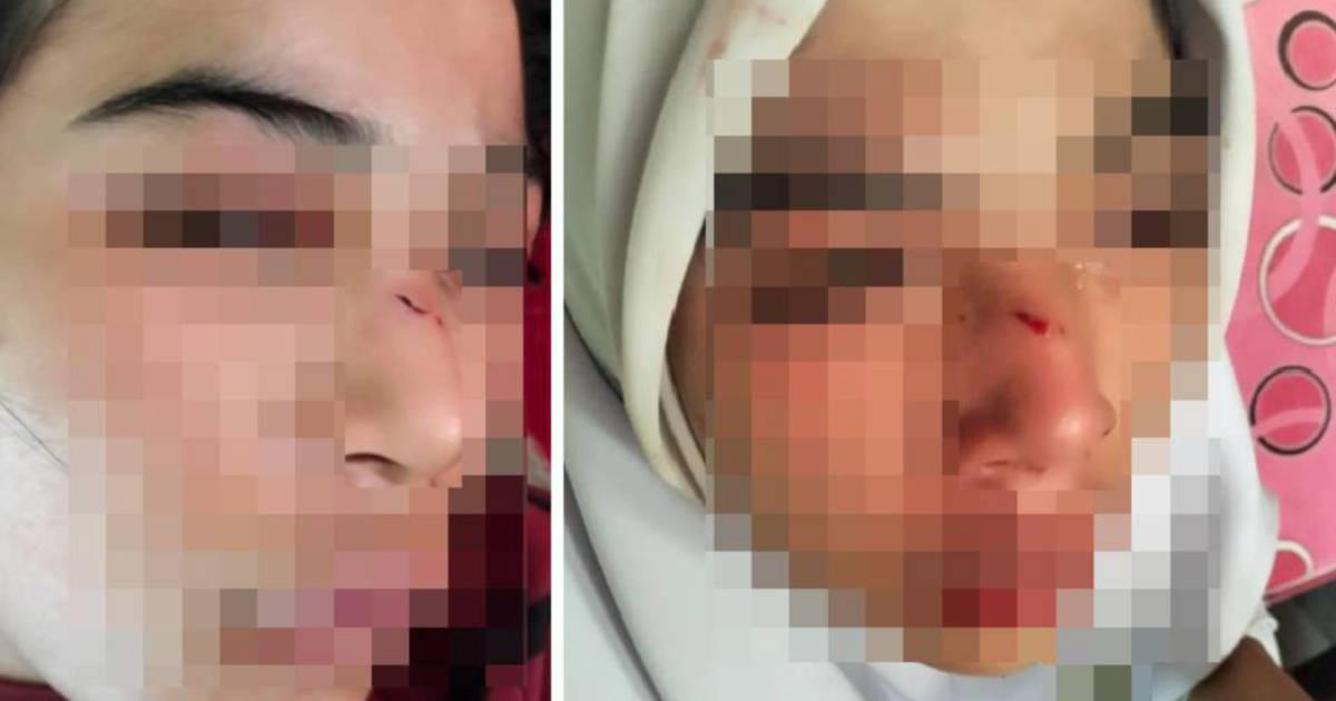 Kelantan Education Department launches probe into student assault case