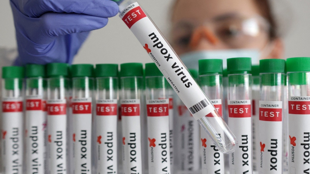 Guinea-Bissau Confirms First Mpox Case as Health Authorities Mobilise Response
