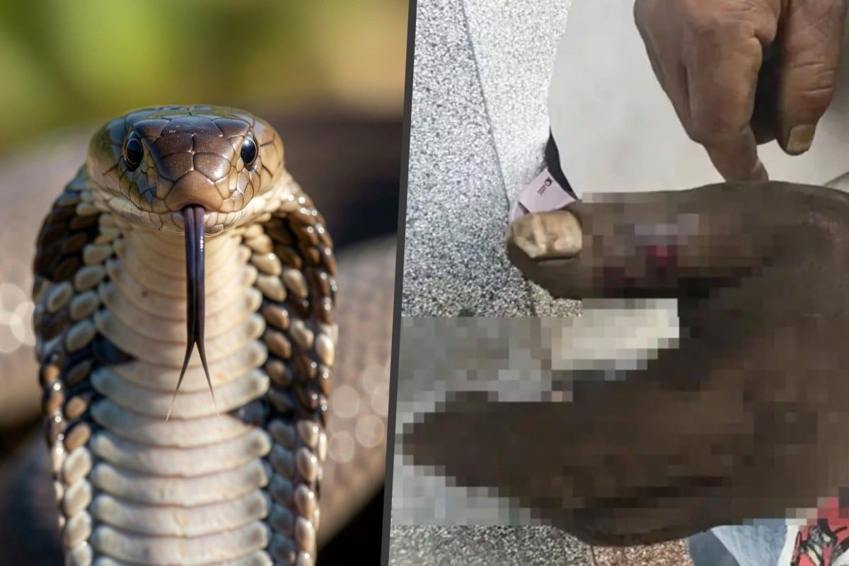 Wife's Well-Intentioned Snake Bite Remedy Backfires, Poisoning Herself in Southern China