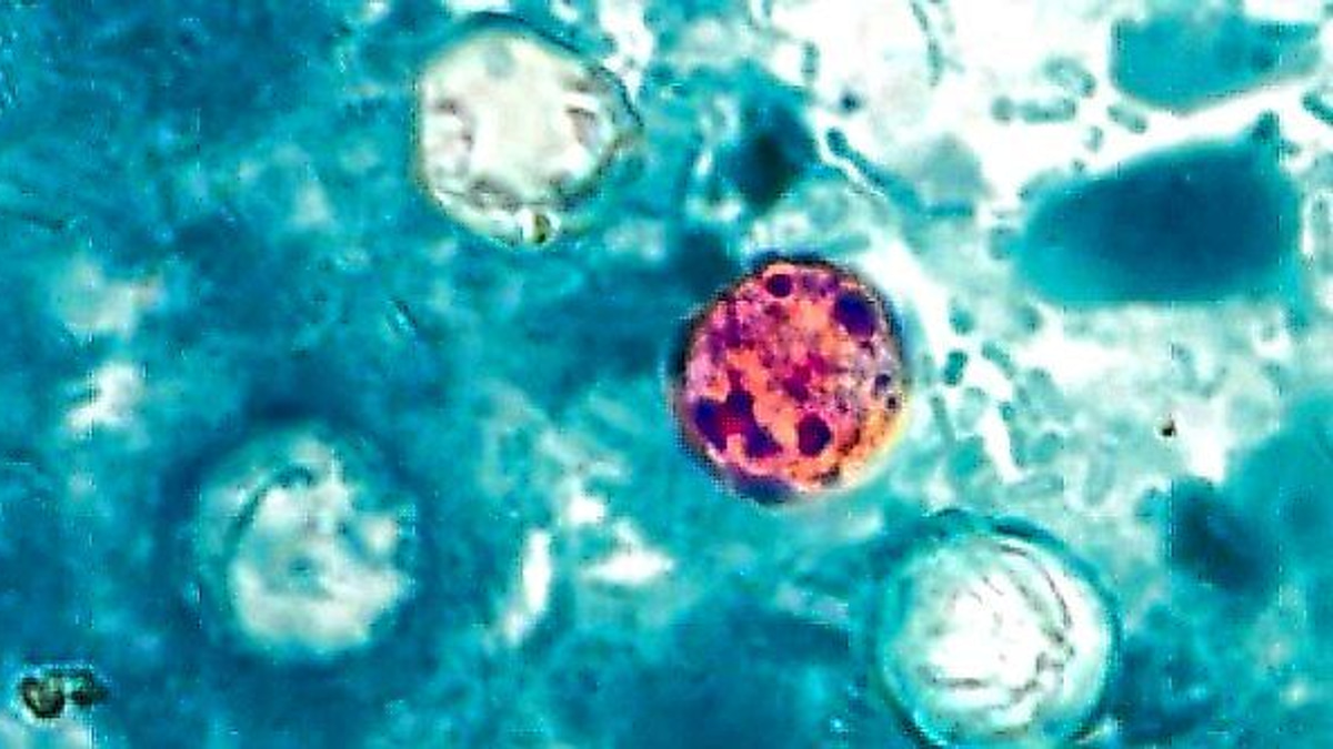 The Invisible Enemy: Why Cyclospora Outbreaks Are So Hard to Contain