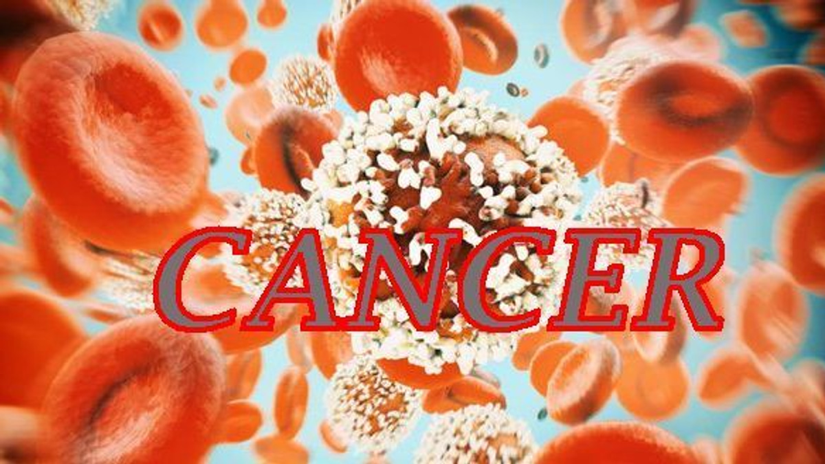 The Silent Threat: Why Colorectal Cancer Is Striking Young Malaysians Earlier Than Ever