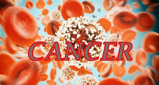 The Silent Threat: Why Colorectal Cancer Is Striking Young Malaysians Earlier Than Ever