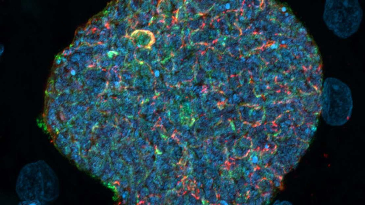 Australian Researchers Develop Malaria Strategy That Harnesses Mosquito Bites as Immune Boosters