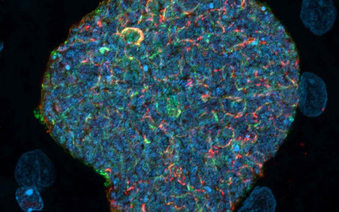 Australian Researchers Develop Malaria Strategy That Harnesses Mosquito Bites as Immune Boosters